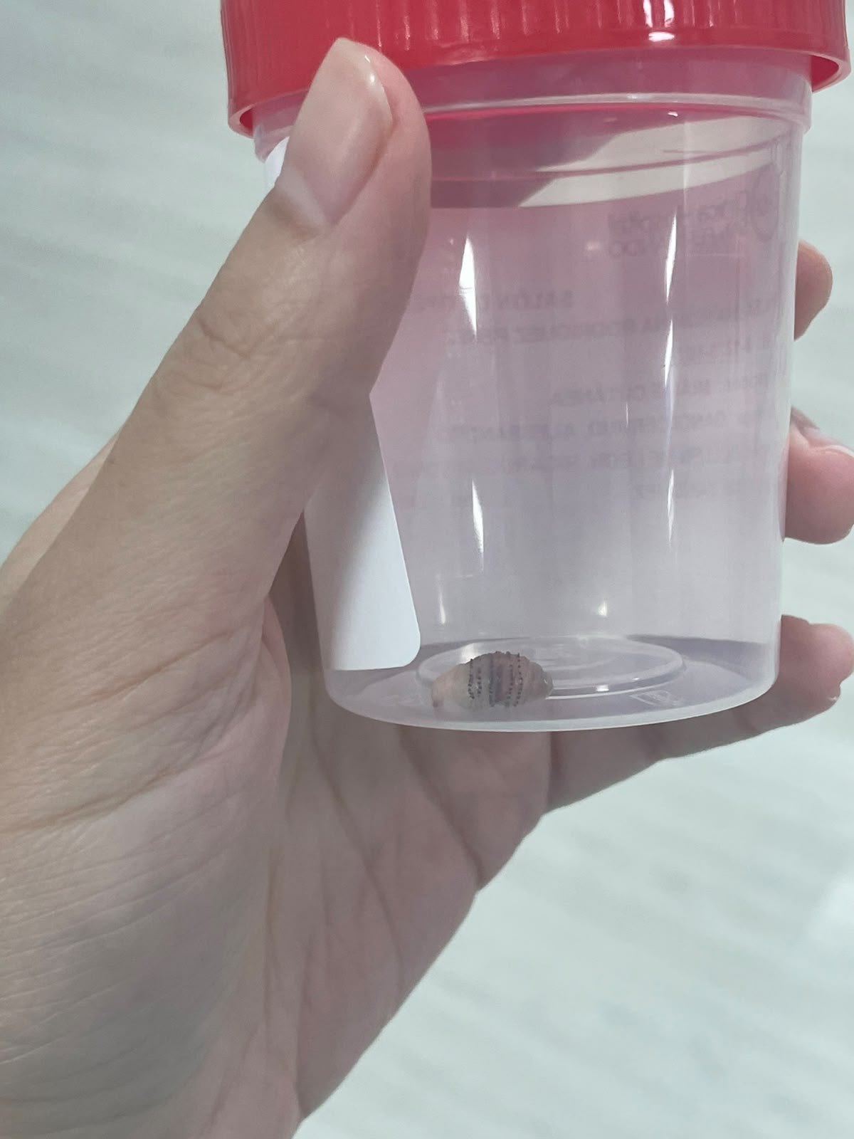 Después: Miasis Cutánea ( Larva )