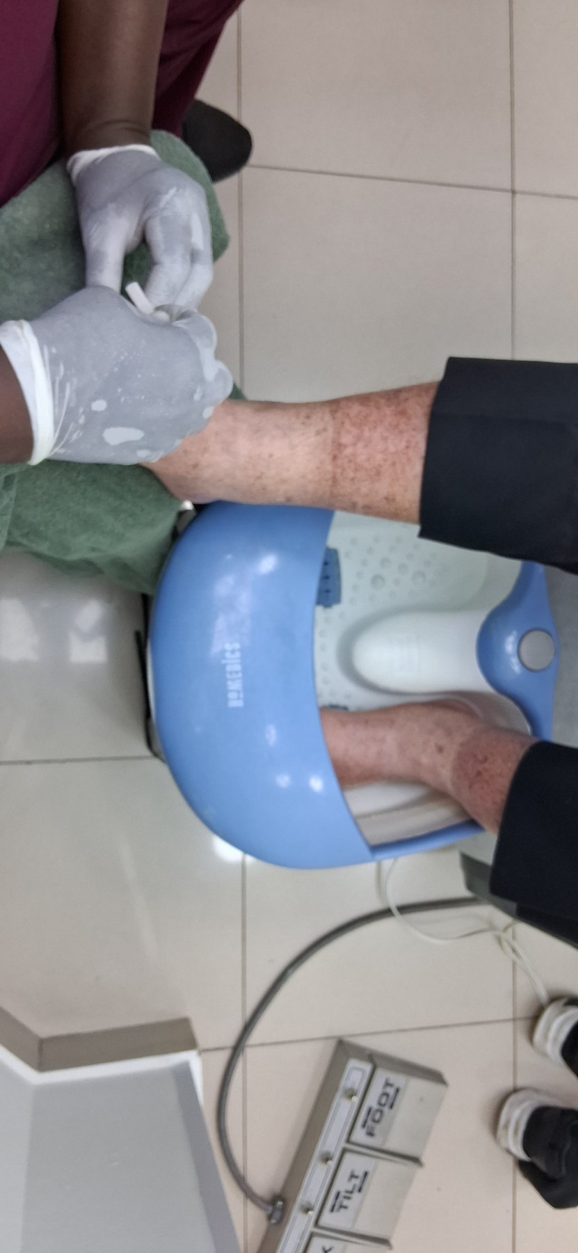 Antes: Cuidado de los pies